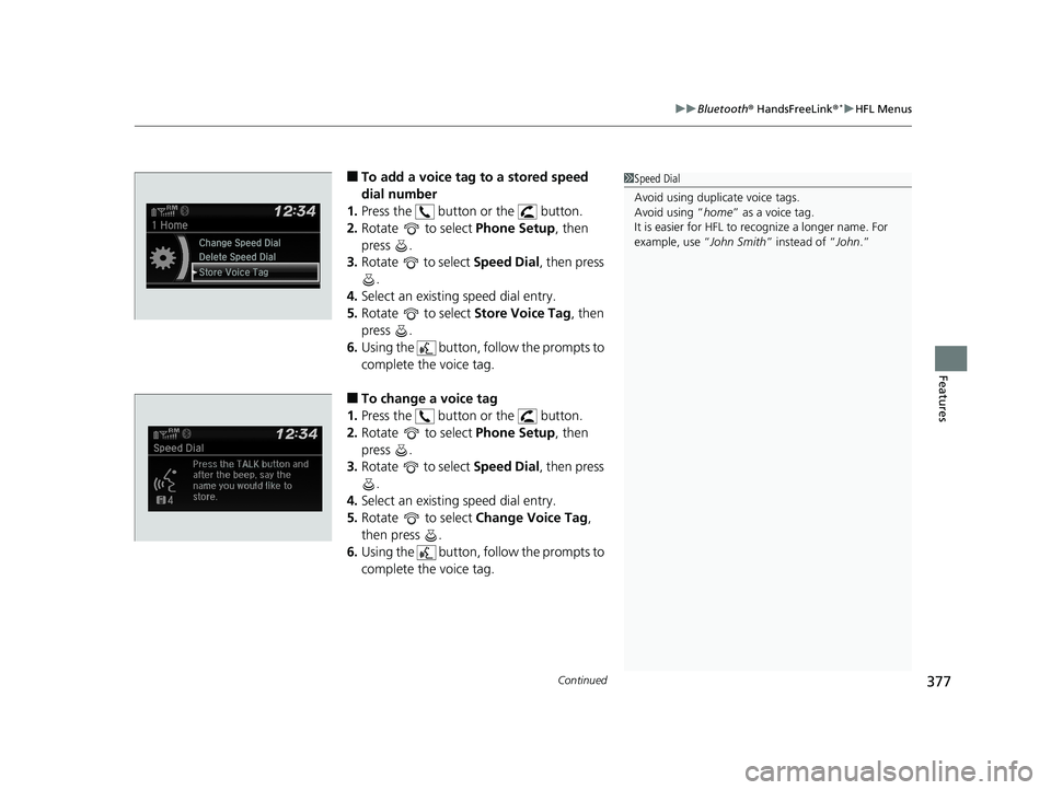 HONDA CIVIC SEDAN 2018 Owners Manual (in English) Continued377
uuBluetooth ® HandsFreeLink ®*uHFL Menus
Features
■To add a voice tag to a stored speed
dial number
1. Press the button or the button.
2. Rotate to select Phone Setup, then
p HONDA CIVIC SEDAN 2018 Owners Manual (in English) Continued377
uuBluetooth ® HandsFreeLink ®*uHFL Menus
Features
■To add a voice tag to a stored speed
dial number
1. Press the button or the button.
2. Rotate to select Phone Setup, then
p