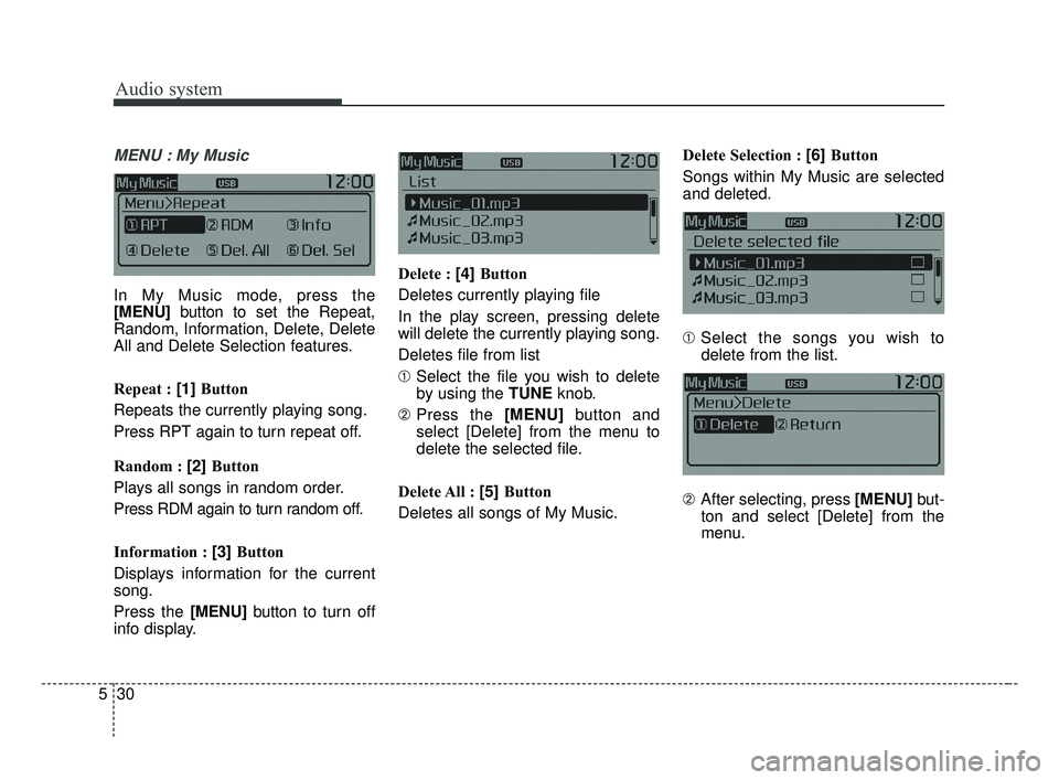 KIA OPTIMA 2017  Owners Manual Audio system
30
5
MENU : My Music
In My Music mode, press the
[MENU]  button to  set the Repeat,
Random, Information, Delete, Delete
All and Delete Selection features.
Repeat : [1]  Button
Repeats the