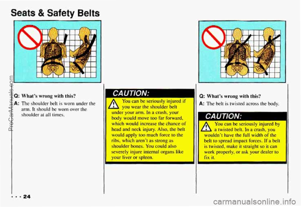 CHEVROLET CAMARO 1993 Owners Manual Selts & 9fety Belts
Q: What’s wrong with this?
A: The shoulder belt is worn under the
arm. It should be worn over the
shoulder
at all times.
I
PAIITlnN~ Q: What’s wrong with this? CHEVROLET CAMARO 1993 Owners Manual Selts & 9fety Belts
Q: What’s wrong with this?
A: The shoulder belt is worn under the
arm. It should be worn over the
shoulder
at all times.
I
PAIITlnN~ Q: What’s wrong with this?