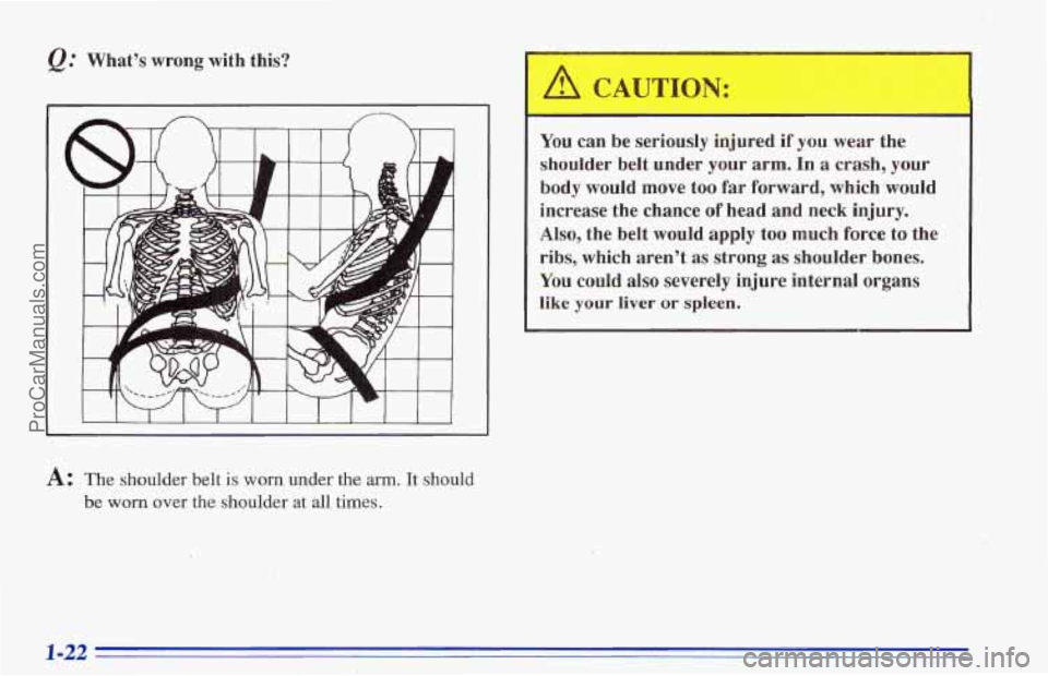 CHEVROLET TRACKER 1996 Owners Manual e. Whats  wrong with this? 
I I 1 1 I I 1 I 1 
A: The shoulder belt is worn, under the arm. It should 
be worn over the shoulder at all times. 
You can  be seriously  injured if you wear  the 
shoul