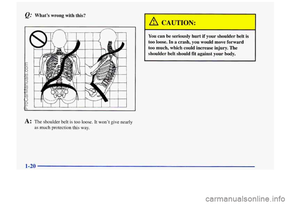 CHEVROLET TRACKER 1997 Owners Manual @ Whats  wrong  with  this? 
A: The shoulder belt  is too  loose. It wont give nearly 
as much protection this way. 
You can  be  seriously  hurt  if  your  shoulder  belt is 
too  loose.  In  a  cr