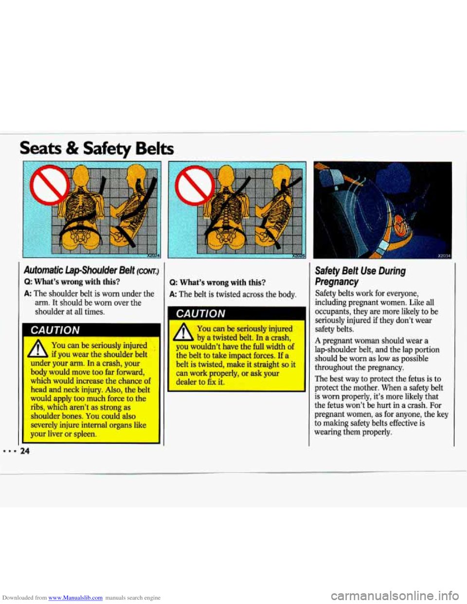 CHEVROLET LUMINA 1993 1.G Owners Manual Downloaded from www.Manualslib.com manuals search engine I Seats & Safety Belts 
Automatic  Lap-Shoulder  Belt (corn) 
Q: Whats  wrong  with  this? 
A The shoulder  belt  is worn  under  the 
arm.  I