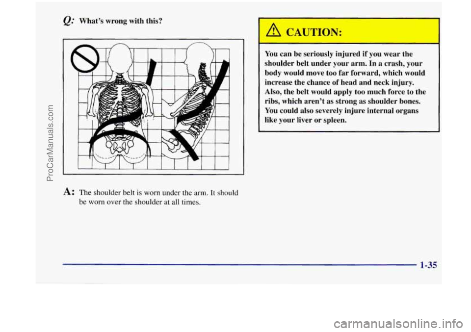 OLDSMOBILE SILHOUETTE 1998 Service Manual Q: What’s wrong with this?
A: The shoulder belt is worn under the arm. It should
be worn over the shoulder at all times.
A CAUTION:
I
You can be seriously injured if you wear the OLDSMOBILE SILHOUETTE 1998 Service Manual Q: What’s wrong with this?
A: The shoulder belt is worn under the arm. It should
be worn over the shoulder at all times.
A CAUTION:
I
You can be seriously injured if you wear the