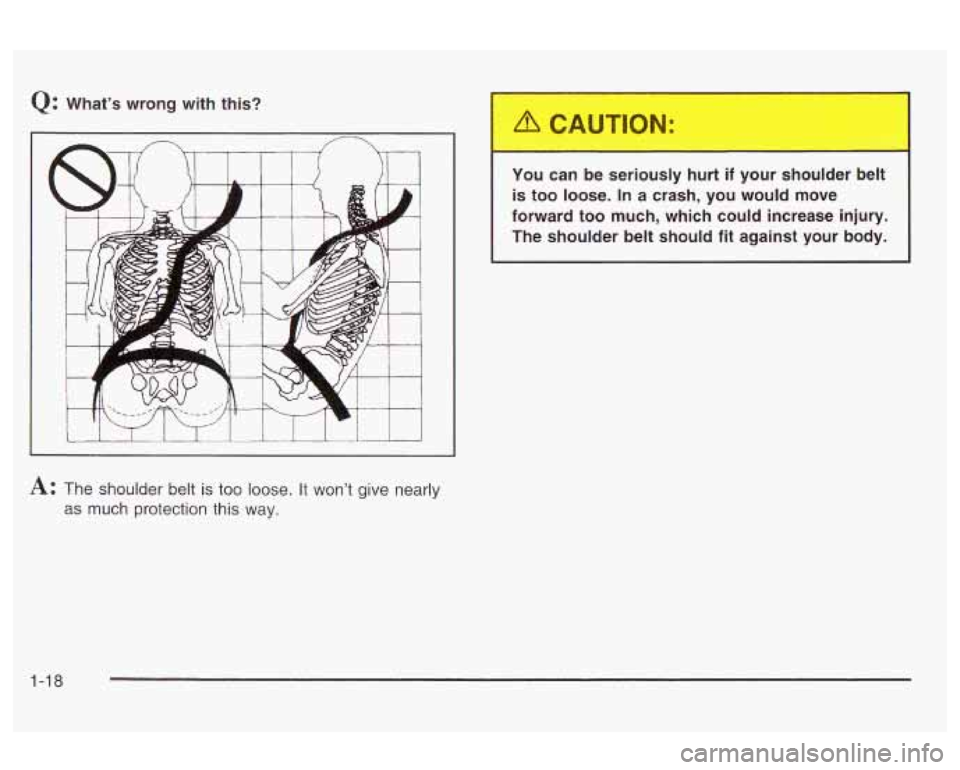 Oldsmobile Alero 2003  s Owners Guide Q: What’s  wrong with this? 
You can be seriously  hurt 
if your  shoulder  belt 
is  too  loose. 
In a crash,  you  would  move 
forward  too  much,  which  could increase  injury. 
The  shoulder  