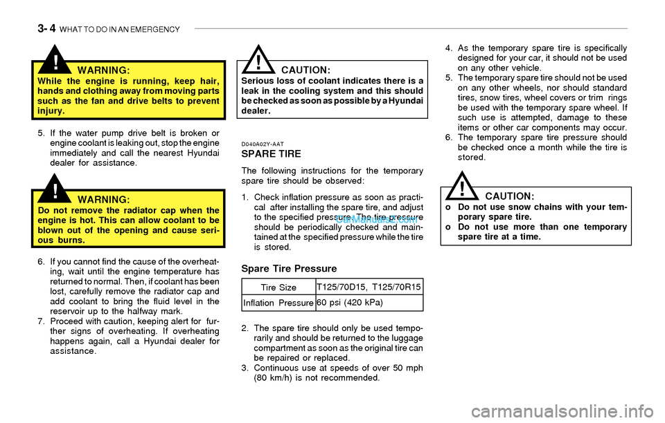 Hyundai Sonata 2004 Owners Manual 3- 4 WHAT TO DO IN AN EMERGENCY
!
!WARNING:While the engine is running, keep hair,
hands and clothing away from moving parts
such as the fan and drive belts to prevent
injury.
D040A02Y-AATSPARE TIRE
Hyundai Sonata 2004 Owners Manual 3- 4 WHAT TO DO IN AN EMERGENCY
!
!WARNING:While the engine is running, keep hair,
hands and clothing away from moving parts
such as the fan and drive belts to prevent
injury.
D040A02Y-AATSPARE TIRE