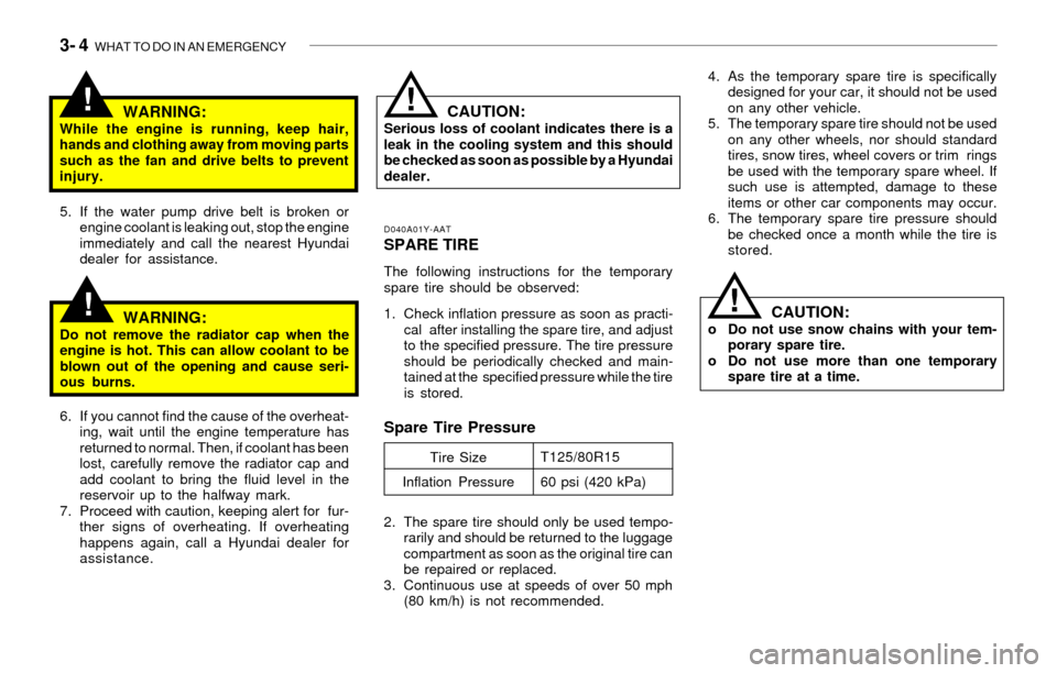 Hyundai Sonata 2003 Owners Manual 3- 4 WHAT TO DO IN AN EMERGENCY
!
!WARNING:While the engine is running, keep hair,
hands and clothing away from moving parts
such as the fan and drive belts to prevent
injury.
D040A01Y-AATSPARE TIRE
Hyundai Sonata 2003 Owners Manual 3- 4 WHAT TO DO IN AN EMERGENCY
!
!WARNING:While the engine is running, keep hair,
hands and clothing away from moving parts
such as the fan and drive belts to prevent
injury.
D040A01Y-AATSPARE TIRE
