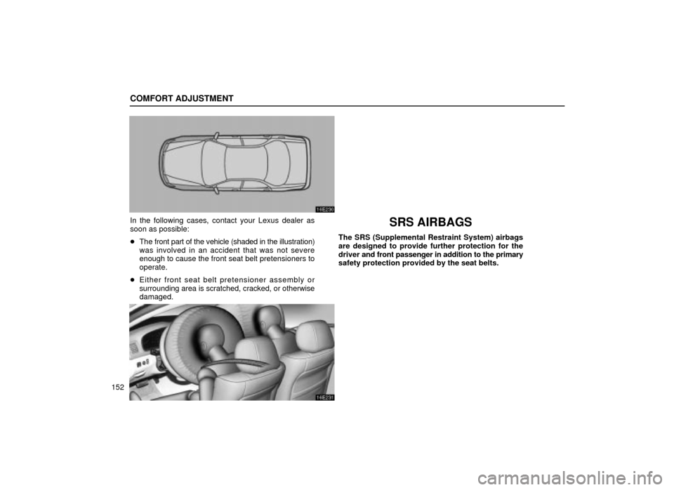 Lexus ES300 2001  Owners Manuals (in English) COMFORT ADJUSTMENT
152
16E230
In the following cases, contact your Lexus dealer as
soon as possible:
The front part of the vehicle (shaded in the illustration)
was involved in an accident that was no