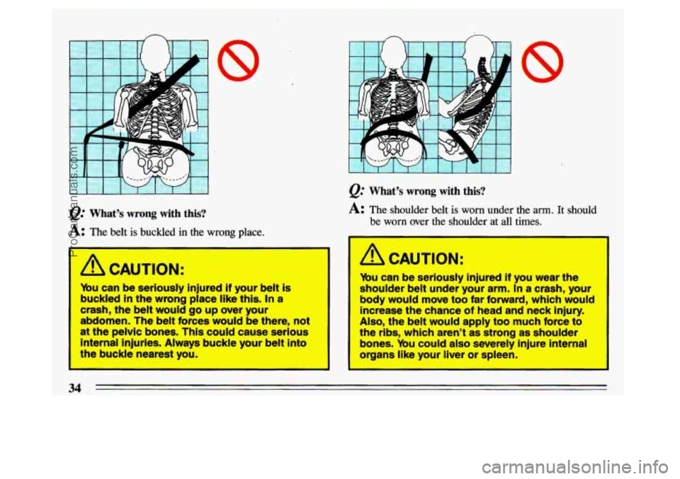 BUICK CENTURY 1993 Owners Guide n 
r 
I I I I I I I 
@ What’s  wrong  with  this? 
A: The  belt  is  buckled  in  the  wrong  place. 
I 
A CAUTION’: 
ybu  can  be seriously  injured if your belt is 
buckled  in the 
wrong place 