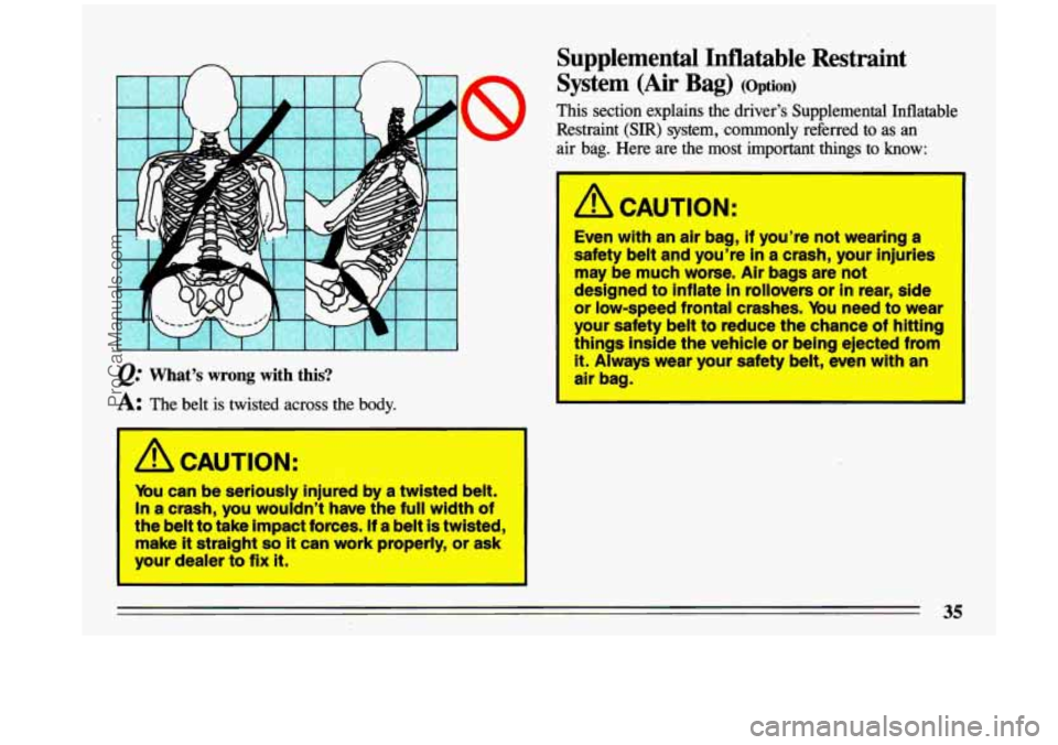 BUICK CENTURY 1993 Owners Guide I I I I I I I I I I I J 
@ What’s  wrong  with  this? 
A: The belt  is  twisted  across  the  body. 
Mu can be seriously injured  by  a twisted  belt. 
In a  crash,  you  wouldn’t  have  the full 