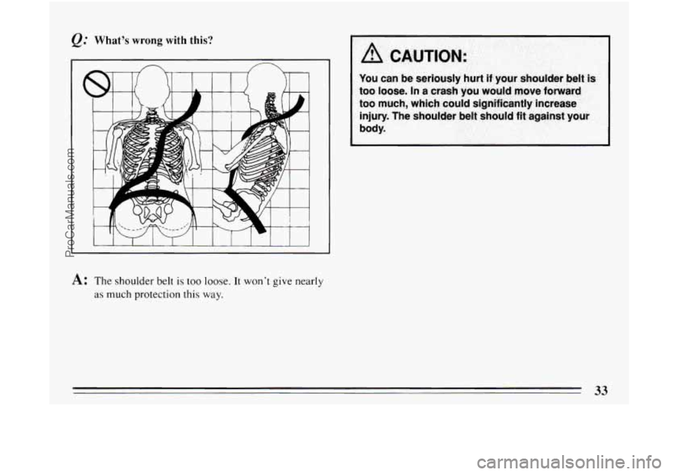 BUICK CENTURY 1994 Owners Guide Q: What’s wrong with this? 
‘A 
I I I  I  I I  I 
A: The shoulder belt is too loose.  It won’t give nearly 
as much protection this way. 
I A CAUTION: 
You  can be seriously  hurt if your  shoul