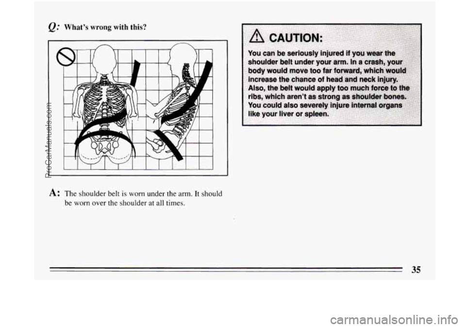 BUICK CENTURY 1994 Owners Guide What’s wrong with  this? 
A: The shoulder belt is worn under the  arm. It should 
be worn  over the shoulder  at all  times. 
35 
ProCarManuals.com 