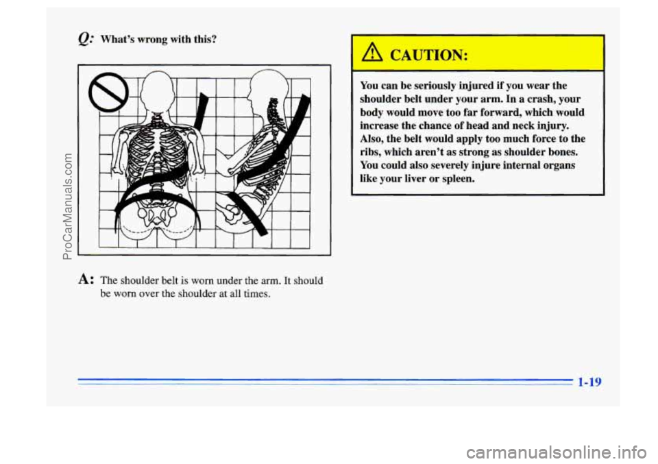 BUICK CENTURY 1996 Owners Guide @ What’s wrong with this?
A
A: The shoulder belt is worn under the arm. It should
be worn over the shoulder at all times.
A C TION:
You can be seriously injured if you wear the
should BUICK CENTURY 1996 Owners Guide @ What’s wrong with this?
A
A: The shoulder belt is worn under the arm. It should
be worn over the shoulder at all times.
A C TION:
You can be seriously injured if you wear the
should