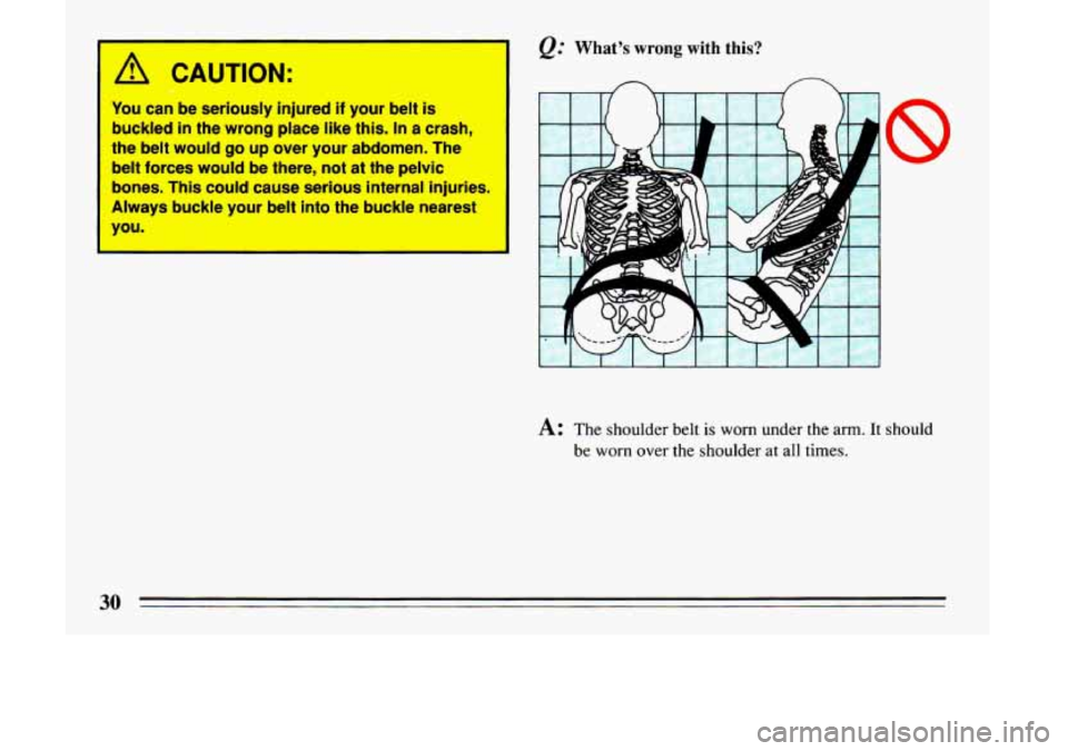BUICK LESABRE 1993 Owners Guide 1 A CAUTION: 
You can  be  seriously  injured if your  belt is 
buckled in the  wrong  place  like this. In a  crash, 
the  belt would 
go up over  your  abdomen.  The 
belt  forces  would be  there, 
