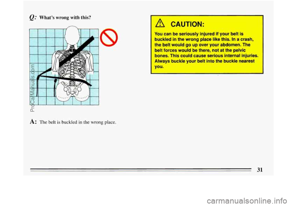 BUICK PARK AVENUE 1993 Owners Guide You can be  seriously  injured if your belt is 
buckled in the wrong  place like this. In a crash, 
the  belt  would  go  up over  your  abdomen.  The 
belt  forces  would be  there, 
not at the pelvi