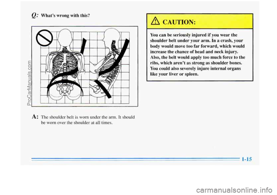 BUICK PARK AVENUE 1996 Owners Manual @ What’s  wrong  with  this? 
You can be seriously  injured if you wear the 
shoulder  belt under  your  arm.  In a crash,  your 
body  would  move 
too far forward,  which  would 
increase  the  ch