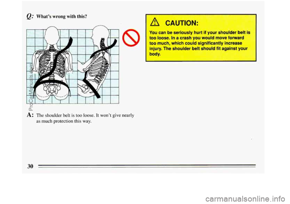 BUICK REGAL 1993 Owners Guide @ What’s wrong with this? 
A: The shoulder  belt is too loose. It won’t give nearly 
as  much protection this  way. 
A CAUTION: 
You can  be  seriously  hurl II your snoulder  belt is 
too  loose.