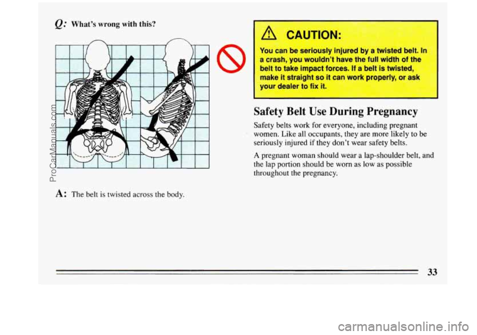 BUICK REGAL 1993 Owners Guide @ What’s wrong with this? 
I I I 
A: The belt is twisted  across  the  body. 
j /r CAUTION: 
You can  be  seriously  injured  by a twisted  belt. In I 
a  crash,  you  wouldn’t  have  the  full wi