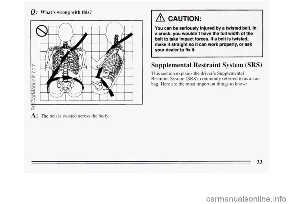 BUICK REGAL 1994 Owners Guide &.’ What’s  wrong  with  this? 
I I  I I 1 I I 1 I 1 I 
A: The belt is twisted across the  body. 
Supplemental Restraint System (SRS) 
This section explains the driver’s  Supplemental 
Restraint