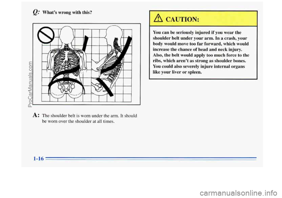 BUICK REGAL 1996 Owners Manual &: Whats  wrong with this? 
You can be seriously  injured if 
you wear the 
shoulder belt  under your arm.  In 
a crash,  your 
body  would  move  too far forward,  which  would 
increase  the chance