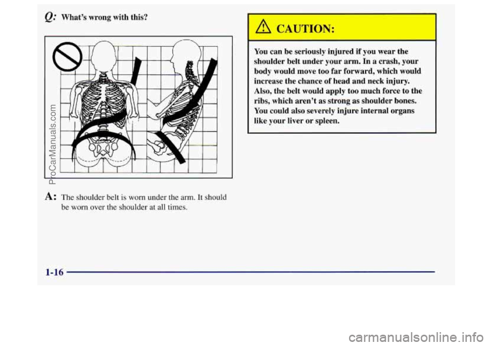BUICK REGAL 1998 Owners Manual Q.’ What’s wrong with this?
A: The shoulder belt is worn under the arm. It should
be
worn over the shoulder at all times. You
can be seriously injured if you wear the
shoulder BUICK REGAL 1998 Owners Manual Q.’ What’s wrong with this?
A: The shoulder belt is worn under the arm. It should
be
worn over the shoulder at all times. You
can be seriously injured if you wear the
shoulder