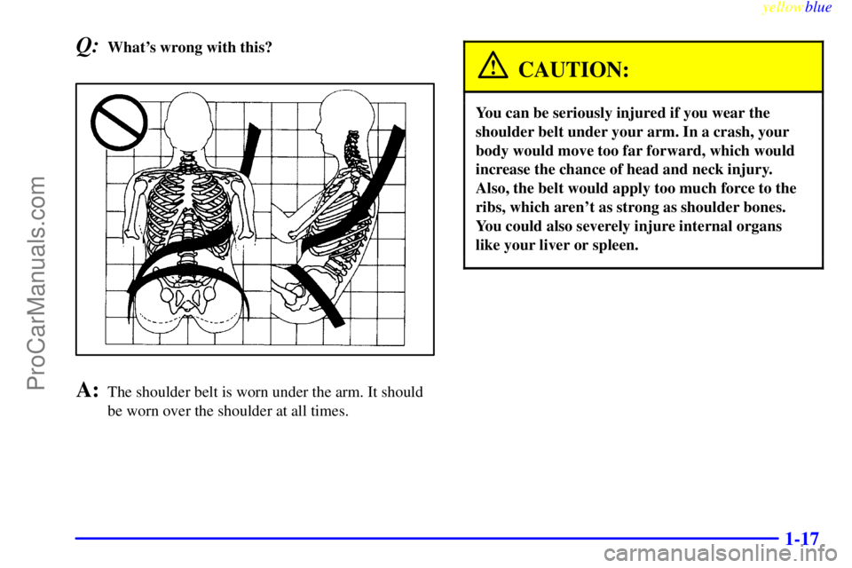 BUICK REGAL 1999 Owners Manual yellowblue
1-17
Q:Whats wrong with this?
A:The shoulder belt is worn under the arm. It should
be worn over the shoulder at all times.
CAUTION:
You can be seriously injured if you wear the
should BUICK REGAL 1999 Owners Manual yellowblue
1-17
Q:Whats wrong with this?
A:The shoulder belt is worn under the arm. It should
be worn over the shoulder at all times.
CAUTION:
You can be seriously injured if you wear the
should