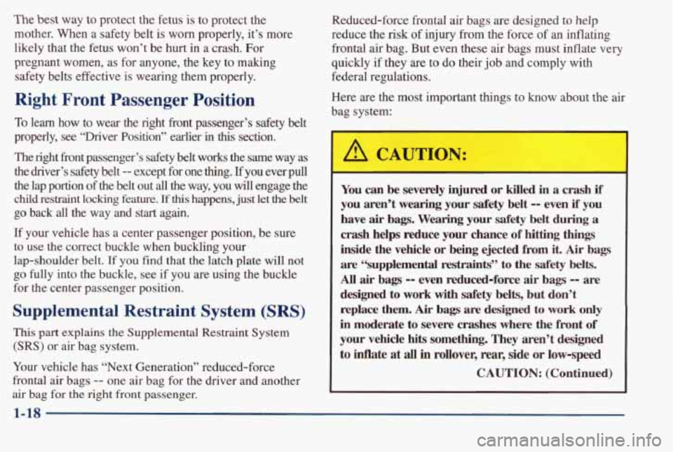 PONTIAC BONNEVILLE 1998 Owners Manual The best way to protect the fetus is to protect the
mother. When a safety belt is
worn properly, it’s more
likely that the fetus won’t be hurt in a crash. For
pregnant wom PONTIAC BONNEVILLE 1998 Owners Manual The best way to protect the fetus is to protect the
mother. When a safety belt is
worn properly, it’s more
likely that the fetus won’t be hurt in a crash. For
pregnant wom