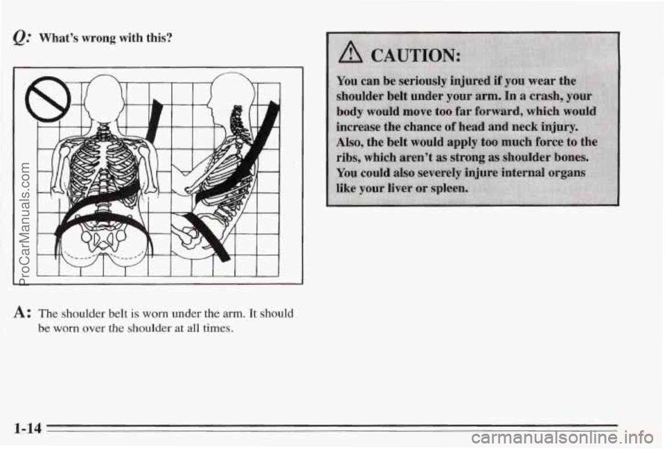 PONTIAC BONNEVILLE 1995 Owners Manual Whats wrong with this?
1
A: The shoulder belt is worn under the arm. It should
j be worn over the shoulder at all times.
1-14
ProCarManuals.com PONTIAC BONNEVILLE 1995 Owners Manual Whats wrong with this?
1
A: The shoulder belt is worn under the arm. It should
j be worn over the shoulder at all times.
1-14
ProCarManuals.com