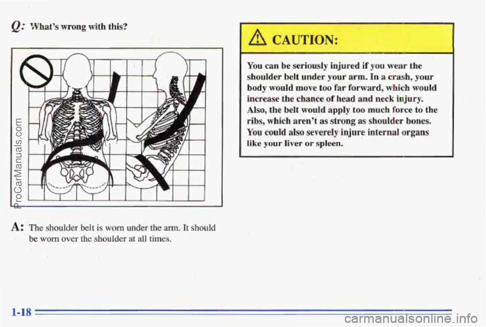 PONTIAC GRAND-AM 1996 Owners Manual I 
A: The shoulder  belt is worn under the arrn. It should 
.. be worn over the shoulder  at  all  times. 
You can b me seriously  injured  if you wear  th 
shoulder  belt  under  your  arm. In a cras