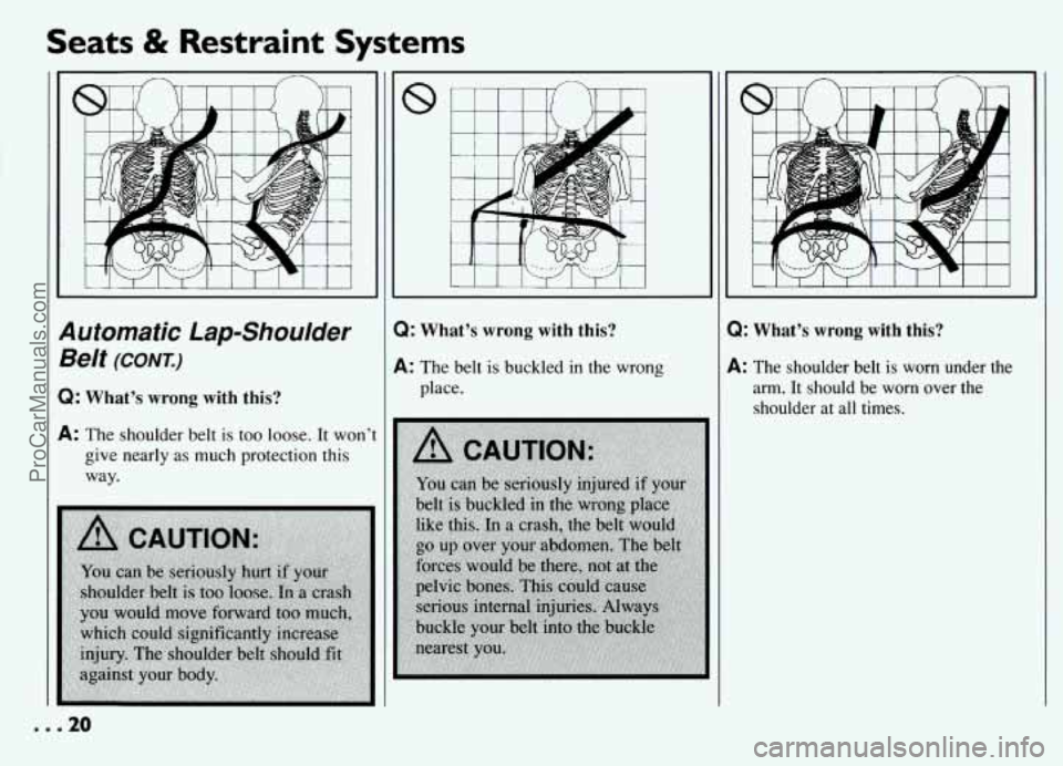 PONTIAC GRAND-AM 1994 Owners Manual Seats & Restraint  Systems 
automatic Lap-Shoulder 
3elt (CONT.) 
3: What’s  wrong with this? 
k The shoulder  belt is too loose. It  won’t 
give  nearly  as much  protection this 
way. 
8 
Q: Wha