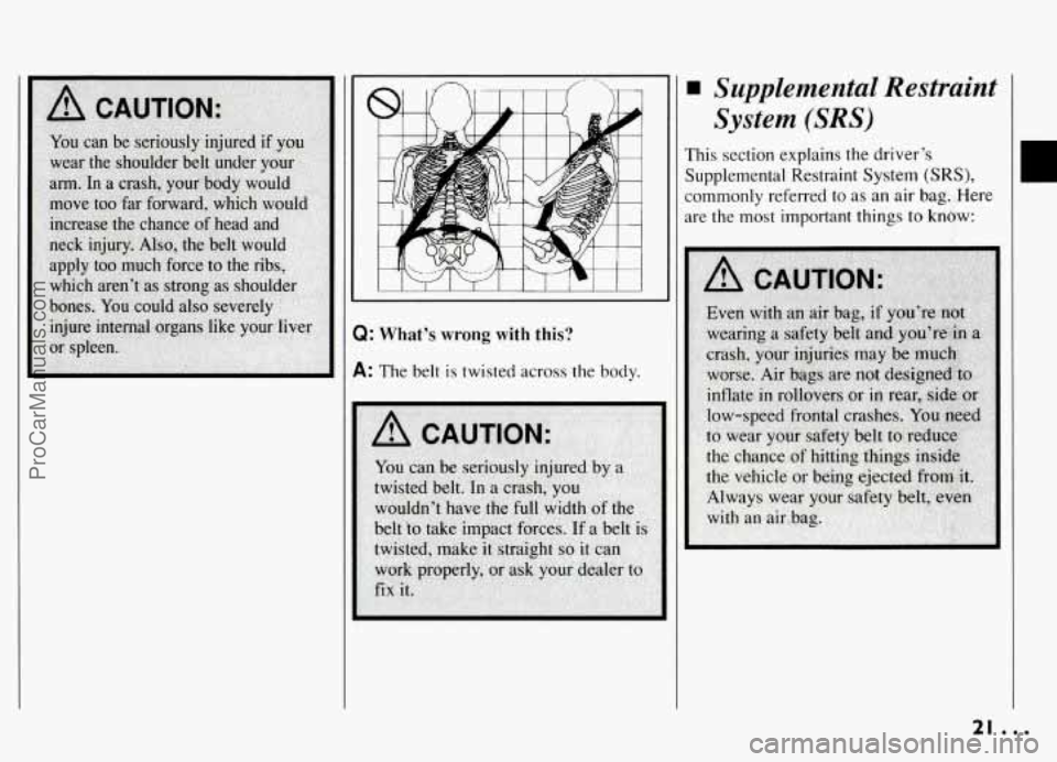 PONTIAC GRAND-AM 1994 Owners Manual Q: What’s wrong with this? 
A: The belt is twisted across the  body. 
supplemental  Restraint 
System 
(SRS) 
This section explains the driver’s 
Supplemental Restraint  System 
(SRS), 
commonly r